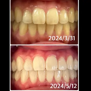 お肌と歯のサロン　Sona Mior所属・藤井 ののみのエステ・リラクイメージ