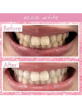 セルフホワイトニング エクシア武蔵小杉店のその他イメージ