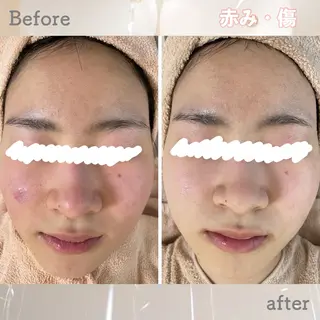 ニキビ&跡改善サロン オーナー光木のエステ・リラクイメージ