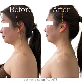 esthetic salon PLANTS所属・エステティックサロン PLANTSのエステ・リラクイメージ