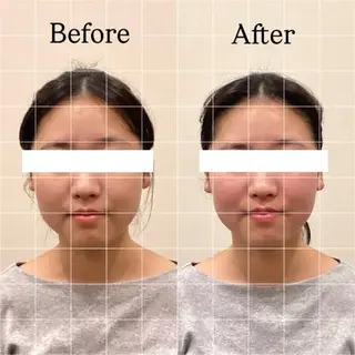 Hari Lounge恵比寿所属・chika🦋 ハリラウンジ恵比寿のエステ・リラクイメージ