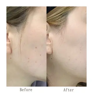 サキ 脱毛.エステ🩵ྀིの眉毛・アイブロウイメージ