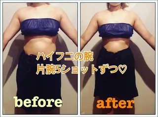 骨盤ダイエット痩身エステサロンBloom所属・坂田 真紀のエステ・リラクイメージ