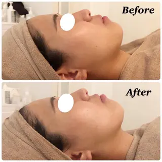 MiMiy 銀座店のエステ・リラクイメージ