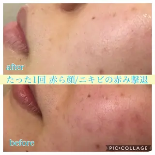 ショート カラー パーマ ヘアアレンジ キッズ ネイル マツエク・マツパ Ensor Clair所属・EnsorClair 代表　野口真央のエステ・リラクイメージ