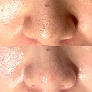 アイラッシュサロン CoCoのマツエク・マツパデザイン