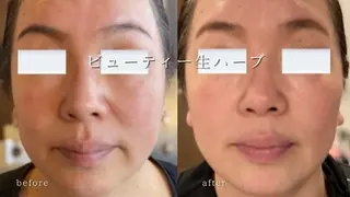 松本 春奈のエステ・リラクイメージ