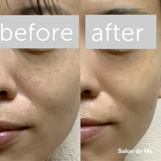 Salon de Me所属・💫Salon de Me💫予約停止中のエステ・リラクイメージ