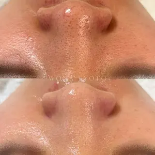 WONA所属・Yamada Rのエステ・リラクイメージ