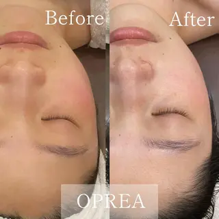 OPREA 千種店のエステ・リラクイメージ