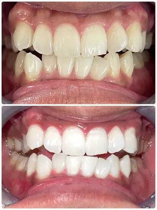 セルフホワイトニング エクシア徳島店マユのその他イメージ