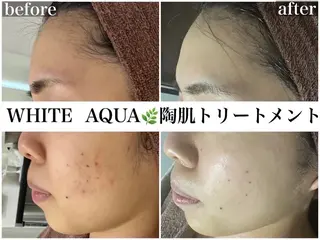 WHITE AQUA 🌼柏店のエステ・リラクイメージ
