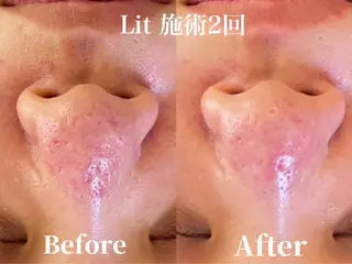 Harry•ハリー🩵韓国コルギとヘアラインのお店所属・韓国肌管理HARRY ・ハリー🤍大村のエステ・リラクイメージ