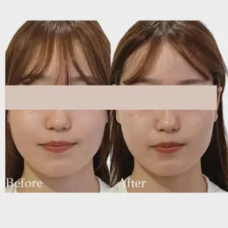 看護師 AYUIのエステ・リラクイメージ