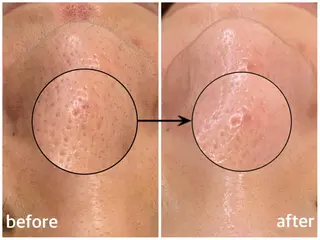 韓国肌管理 【毛穴専科】のエステ・リラクイメージ