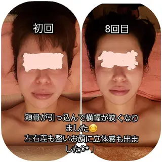 毛穴ケア くすみ肌 ハーブピーリングのエステ・リラクイメージ