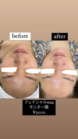 Lotus.所属・Lotus. makoのエステ・リラクイメージ