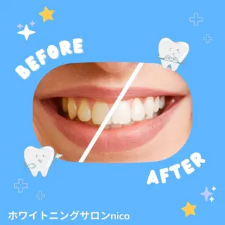 ロング パーマ ホワイトニングサロン nico西葛西店のその他イメージ