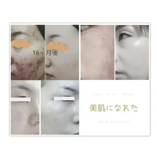 メディカルサロン  風露のエステ・リラクイメージ