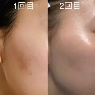 【肌質改善サロン】 リーフィアのエステ・リラクイメージ