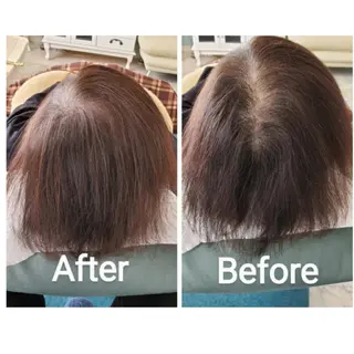 歯科提携セルフダック 宇都宮駒生店のエステ・リラクイメージ