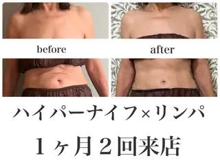 REME/リミー エステサロン東大宮店所属・小林 雪乃のエステ・リラクイメージ