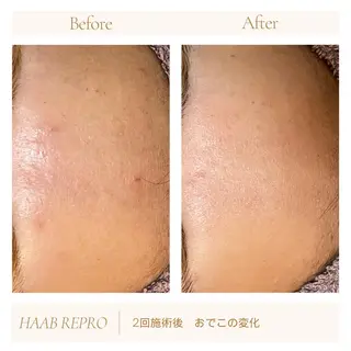 1ヶ月後も半分残る 高持続LEDエクステのマツエク・マツパデザイン