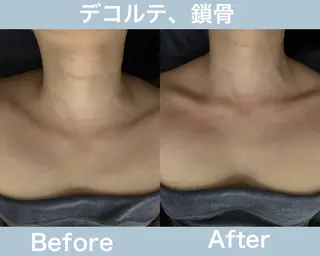 タイ古式マッサージ 白金台 目黒のエステ・リラクイメージ