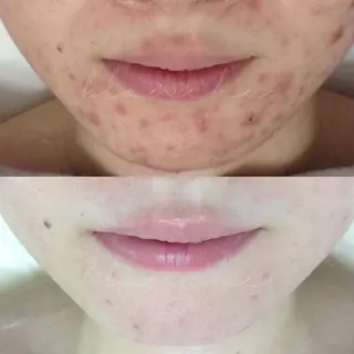 ミディアム カラー パーマ ヘアアレンジ ネイル マツエク・マツパ アイブロウ 都度払い肌質改善 &脱毛Blancheのエステ・リラクイメージ