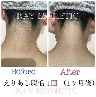 ネイル マツエク・マツパ レイフィールド江南店所属・レイエステティック 江南店のエステ・リラクイメージ