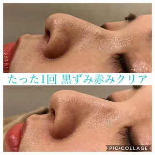 セミロング カラー パーマ ヘアアレンジ キッズ ネイル マツエク・マツパ Ensor Clair所属・EnsorClair 代表　野口真央のエステ・リラクイメージ