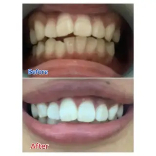 M渋谷店所属・M渋谷 ホワイトニングのエステ・リラクイメージ