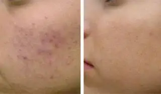 エステサロン オルガスタイルのエステ・リラクイメージ