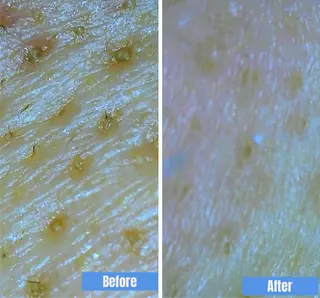 ð
ð
€ð
©ð
ð
salonã®ãšã¹ãã»ãªã©ã¯ã€ã¡ãŒãž