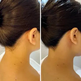 うなじ脱毛/美肌脱毛 LABELのエステ・リラクイメージ