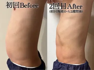 メンズ 六本木/似合わせ眉毛 andＳ🍀Yuriのエステ・リラクイメージ