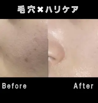 🌿小顔・痩身・脱毛 レイビス川崎店🌿のエステ・リラクイメージ