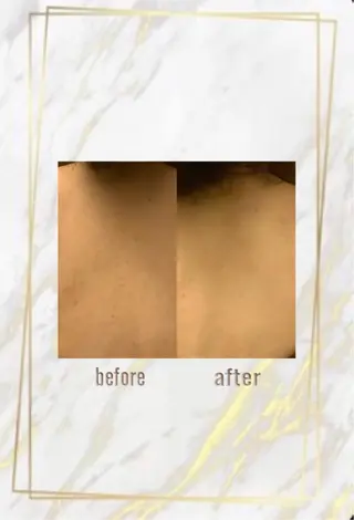 ハーブピーリング特選 認定rebirthのエステ・リラクイメージ