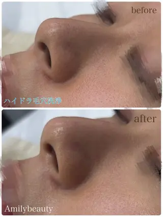 Amilybeauty所属・Amily beauty 毛利のエステ・リラクイメージ