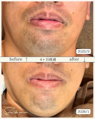 吉沢 晴のエステ・リラクイメージ