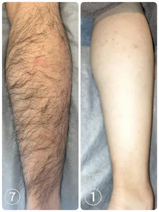 脱毛・眉毛・フェイス サロンN久留米店の眉毛・アイブロウイメージ