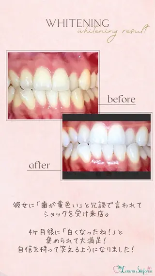 ホワイトニングサロンLuana-Sinfonia(エクシア)池袋店所属・セルフホワイトニング エクシア 池袋店のその他イメージ