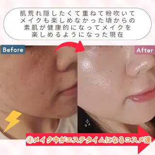 痩身ハーブピーリング 筋膜リリース☆B&Hのエステ・リラクイメージ