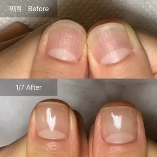 ネイル 木村 千晴のネイルデザイン