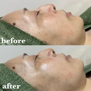 【肌質改善サロン】 リーフィアのエステ・リラクイメージ