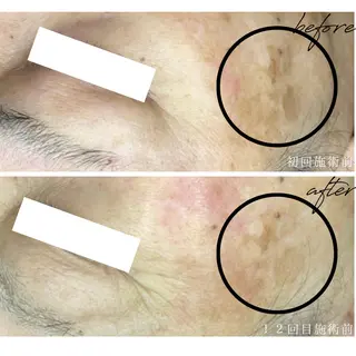 最新シミケアLily de pearlのエステ・リラクイメージ