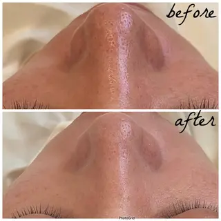 メンズ メナード岐阜市茜部 杉浦のエステ・リラクイメージ