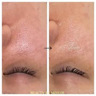 ビューティー ミロワールのエステ・リラクイメージ