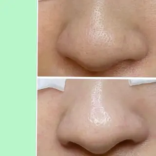 Lipula リプラ所属・毛穴ツヤ肌専門    Lipulaのエステ・リラクイメージ