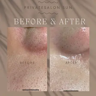 肌質改善サロン🌻 Nico laughのエステ・リラクイメージ